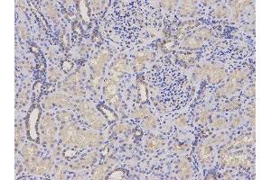 Immunohistochemistry (IHC) image for anti-Proteasome (Prosome, Macropain) 26S Subunit, ATPase, 4 (PSMC4) antibody (ABIN1874384) (PSMC4 抗体)