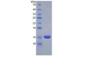 SDS-PAGE of Protein Standard from the Kit (Highly purified E. (Luteinizing Hormone ELISA 试剂盒)