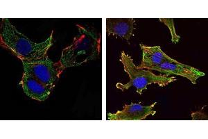 Immunofluorescence analysis of NTERA-2 cells (left) and U251 (right) cells using KLHL13 mouse mAb (green). (KLHL13 抗体)