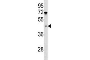 ISL1 antibody western blot analysis in MDA-MB231 lysate. (ISL1 抗体  (AA 156-185))
