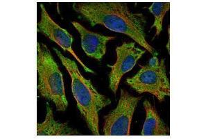 ICC/IF Image Confocal immunofluorescence analysis (Olympus FV10i) of methanol-fixed HeLa, using Villin, antibody (Green) at 1:500 dilution. (Villin 1 抗体  (N-Term))