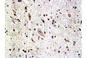 Formalin-fixed and paraffin embedded: rat spinal cord tissue labeled with Anti-Neurofascin Polyclonal Antibody, Unconjugated (ABIN727325) at 1:200, followed by conjugation to the secondary antibody and DAB staining (NFASC 抗体  (AA 501-650))