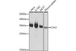 Western blot analysis of extracts of various cell lines, using CDK2 Rabbit pAb  at 1:1000 dilution. (CDK2 抗体)