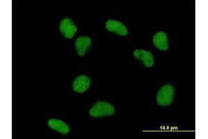 Immunofluorescence of purified MaxPab antibody to TDG on HeLa cell.