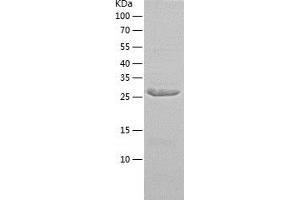 Western Blotting (WB) image for ATG5 Autophagy Related 5 (ATG5) (AA 1-275) protein (His-IF2DI Tag) (ABIN7121922)