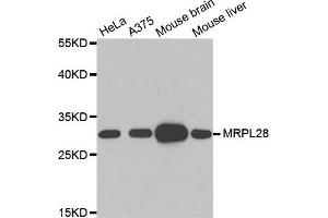 Western Blotting (WB) image for anti-Mitochondrial Ribosomal Protein L28 (MRPL28) antibody (ABIN1876936) (MRPL28 抗体)