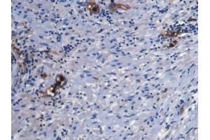 Immunohistochemistry (IHC) image for anti-S100 Calcium Binding Protein A8 (S100A8) (AA 1-93) antibody (ABIN7428836)