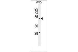Western blot analysis in WiDr cell line lysates (35 µg/lane) using RT4I1 Antibody (C-term) Cat. (RTN4IP1 抗体  (C-Term))