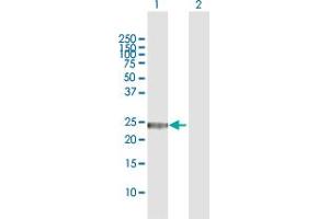 Western Blotting (WB) image for anti-Glutathione Transferase zeta 1 (Maleylacetoacetate Isomerase) (GSTZ1) (AA 1-216) antibody (ABIN516247)