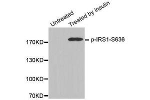 Western blot analysis of extracts from 3T3 cells, using Phospho-IRS1-S636 antibody (ABIN2987656). (IRS1 抗体  (pSer636))