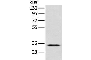 Western blot analysis of Jurkat cell using CD1D Polyclonal Antibody at dilution of 1:300 (CD1d 抗体)