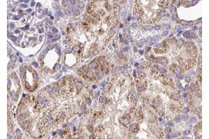 ABIN6268802 at 1/100 staining human kidney tissue sections by IHC-P. (EPH Receptor A3 抗体  (C-Term))