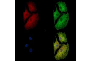 PPAP2A Antibody staining A549 cells by IF/ICC.
