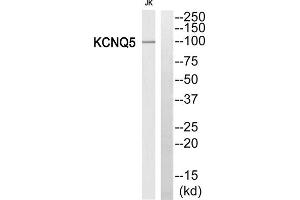 Western blot analysis of extracts from Jurkat cells, using KCNQ5 antibody. (KCNQ5 抗体  (Internal Region))