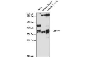 Western blot analysis of extracts of various cell lines, using MB antibody (ABIN6128286, ABIN6143576, ABIN6143577 and ABIN6215296) at 1:3000 dilution. (MAT2B 抗体  (AA 1-334))