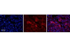 Rabbit Anti-EEA1 Antibody      Formalin Fixed Paraffin Embedded Tissue: Human Adult Liver   Observed Staining: Cytoplasm in hepatocytes, moderate signal, moderate tissue distribution  Primary Antibody Concentration: 1:100  Secondary Antibody: Donkey anti-Rabbit-Cy3  Secondary Antibody Concentration: 1:200  Magnification: 20X  Exposure Time: 0. (EEA1 抗体  (N-Term))