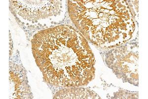 ABIN7094854 and ABIN7098905 at 1/100 staining Rat testis tissue by IHC-P. (PRRG4 抗体  (Internal Region))