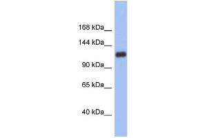 WB Suggested Anti-HIF1A Antibody Titration:  0. (HIF1A 抗体  (Middle Region))