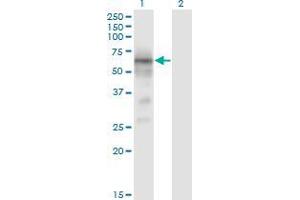 Western Blot analysis of BACE1 expression in transfected 293T cell line by BACE1 monoclonal antibody (M01), clone 2C1. (BACE1 抗体  (AA 22-501))