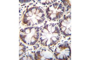 Immunohistochemistry (Paraffin-embedded Sections) (IHC (p)) image for anti-Solute Carrier Family 36 (Proton/amino Acid Symporter), Member 1 (SLC36A1) (AA 1-30), (N-Term) antibody (ABIN656104)