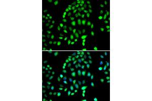 Immunofluorescence analysis of MCF7 cell using PARP3 antibody. (PARP3 抗体)