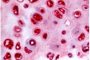 Anti-ADAMTS5 antibody  ABIN1048295 IHC staining of human cartilage. (ADAMTS5 抗体  (Metalloprotease Domain))