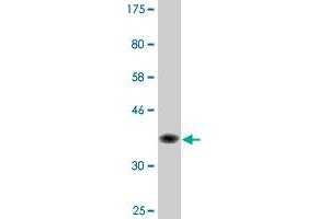 Western Blot detection against Immunogen (36. (Recoverin 抗体  (AA 101-199))