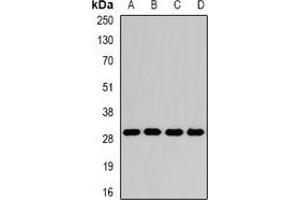Western blot analysis of GAMT expression in Jurkat (A), Hela (B), mouse liver (C), rat brain (D) whole cell lysates.