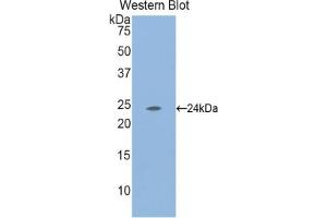 Detection of Recombinant LAMa2, Mouse using Polyclonal Antibody to Laminin Alpha 2 (LAMa2) (Laminin 抗体  (AA 2901-3106))