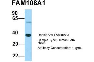 Host: Rabbit  Target Name: FAM108A1  Sample Tissue: Human Fetal Heart  Antibody Dilution: 1. (ABHD17A 抗体  (C-Term))