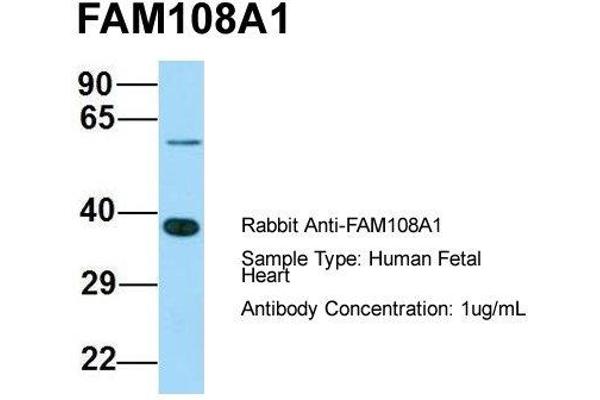 ABHD17A 抗体  (C-Term)