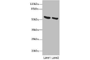 Western blot All lanes: PNPLA2 antibody at 10 μg/mL Lane 1: Mouse liver tissue Lane 2: NIH/3T3 whole cell lysate Secondary Goat polyclonal to rabbit IgG at 1/10000 dilution Predicted band size: 56, 20 kDa Observed band size: 56 kDa (PNPLA2 抗体  (AA 1-504))
