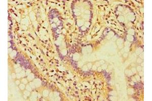 Immunohistochemistry of paraffin-embedded human small intestine tissue using ABIN7146954 at dilution of 1:100 (Caspase 6 抗体  (AA 24-293))