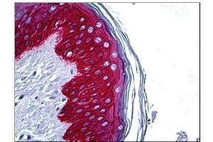 Human Skin: Formalin-Fixed, Paraffin-Embedded (FFPE) (KRT14 抗体  (C-Term))