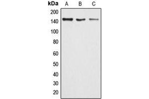 Western blot analysis of ARID4B expression in HeLa (A), MCF7 (B), rat lung (C) whole cell lysates. (BRCAA1 抗体  (Center))