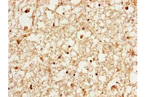 IHC image of ABIN7142087 diluted at 1:1000 and staining in paraffin-embedded human brain tissue performed on a Leica BondTM system. (YWHAE 抗体  (AA 1-255))