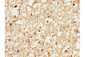 IHC image of ABIN7142087 diluted at 1:1000 and staining in paraffin-embedded human brain tissue performed on a Leica BondTM system.