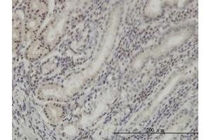 Image no. 1 for anti-Distal-Less Homeobox Protein 2 (DLX2) (AA 1-110) antibody (ABIN598648) (DLX2 抗体  (AA 1-110))