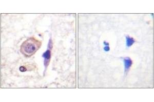 Immunohistochemistry analysis of paraffin-embedded human brain tissue, using Interferon-gamma Receptor alpha chain (Ab-457) Antibody. (IFNGR1 抗体  (AA 431-480))