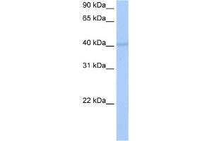 WB Suggested Anti-RBM4 Antibody Titration:  0. (RBM4 抗体  (C-Term))