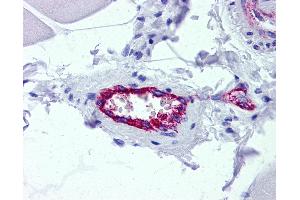 anti-Achalasia, Adrenocortical Insufficiency, Alacrimia (AAAS) (AA 1-101) antibody