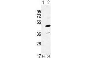 Western blot analysis of IRAK4 antibody and 293 cell lysate either nontransfected (Lane 1) or transiently transfected (2) with the IRAK4 gene. (IRAK4 抗体  (AA 5-36))