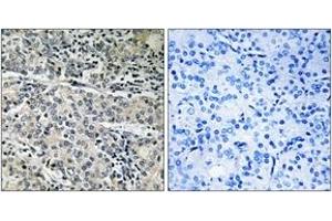 Immunohistochemistry analysis of paraffin-embedded human prostate carcinoma tissue, using MP68 Antibody. (C14orf2 抗体  (AA 9-58))