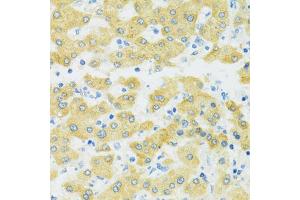 Immunohistochemistry (IHC) image for anti-Solute Carrier Family 37 (Glucose-6-Phosphate Transporter), Member 4 (SLC37A4) (C-Term) antibody (ABIN7270453)