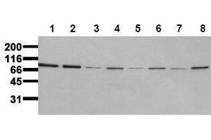 Western Blotting (WB) image for anti-Insulin Receptor (INSR) (Beta Chain) antibody (ABIN126821) (Insulin Receptor 抗体  (Beta Chain))