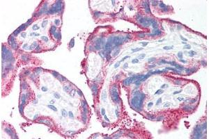 Human Placenta (formalin-fixed, paraffin-embedded) stained with CD59 antibody ABIN214204 at 20 ug/ml followed by biotinylated anti-mouse IgG secondary antibody ABIN481714, alkaline phosphatase-streptavidin and chromogen. (CD59 抗体)