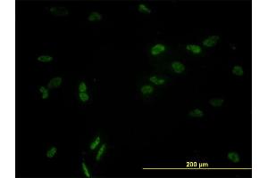 Immunofluorescence of monoclonal antibody to CCNL1 on HeLa cell. (Cyclin L1 抗体  (AA 1-172))