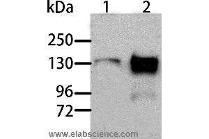 Western blot analysis of Human liver cancer and normal liver tissue, using AOX1 Polyclonal Antibody at dilution of 1:1000