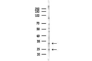 Western blot analysis of lysates from COLO205 cells(heat-shock,45 min treatment), using SCGN Antibody at 1/1000 dilution.