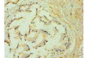 Immunohistochemistry of paraffin-embedded human prostate tissue using ABIN7157843 at dilution of 1:100 (GLO1 抗体  (AA 1-184))